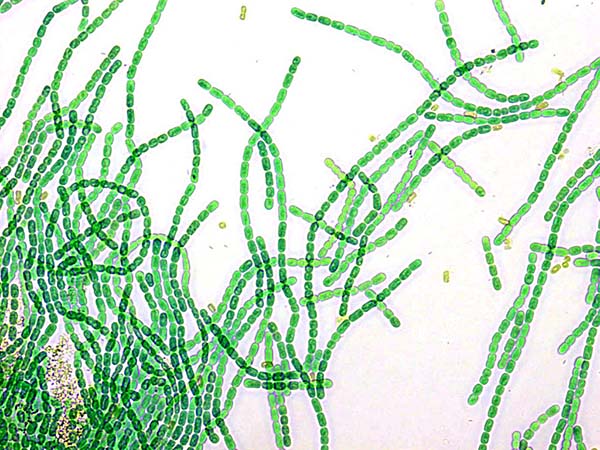 Картинки по запросу сине-зеленые водоросли