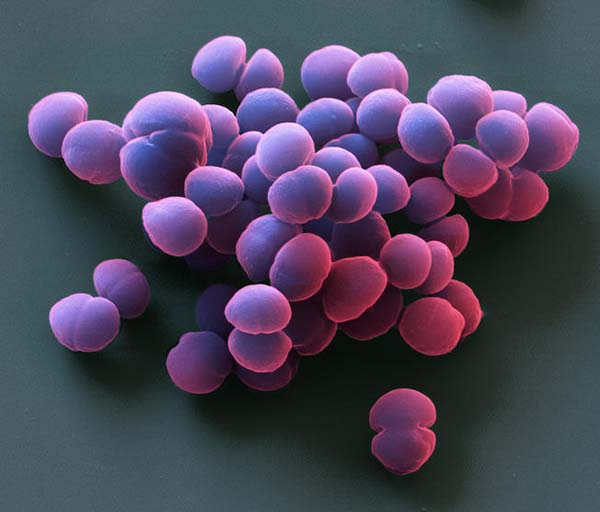 Эпидермальный стафилококк Staphylococcus epidermidis