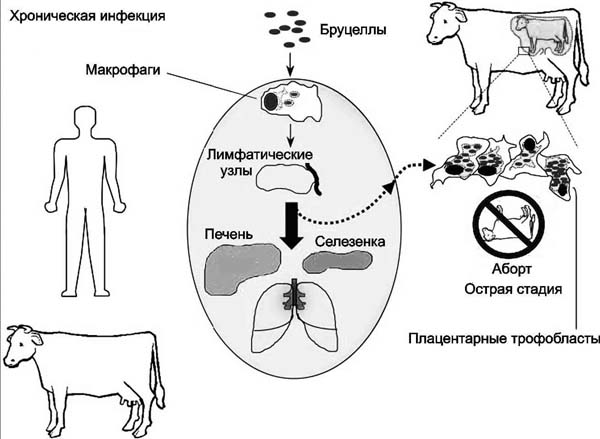 Схема лечения бруцеллеза у человека